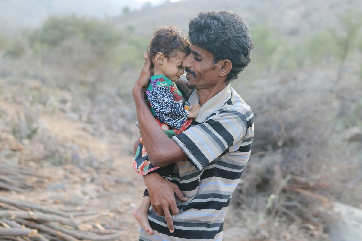 Un padre yemenita con in braccio la sua bambina denutrita