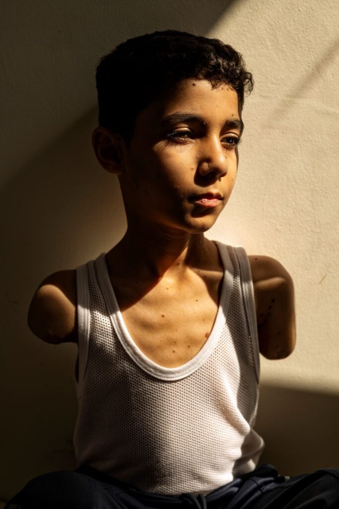 "Mahmoud Ajjour, nove anni". Mahmoud, ferito durante un attacco israeliano a Gaza City nel marzo 2024, trova rifugio e assistenza medica a Doha, in Qatar. 28 giugno 2024.