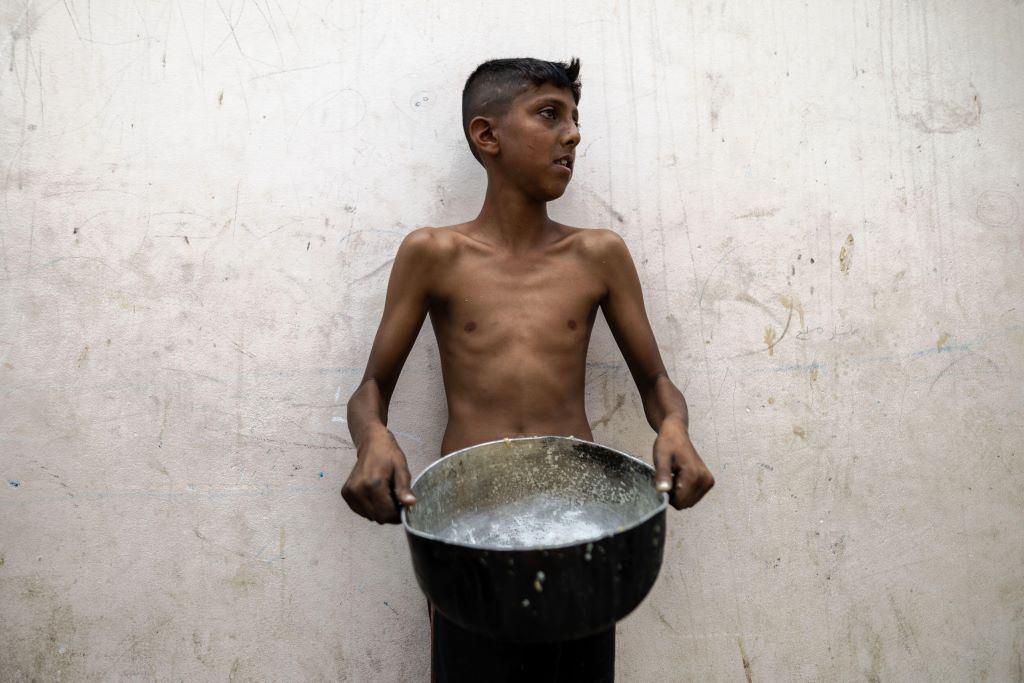 Un ragazzo visibilmente malnutrito aspetta la sua razione di cibo a Gaza City, 18 maggio 2025